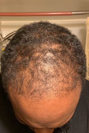 Before Image
