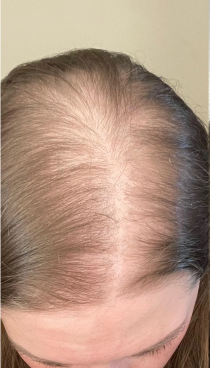 Before Image