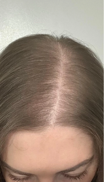 After Image
